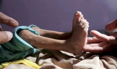 العيد حزين في اليمن.. فرحة تغيب تحت أنقاض الجوع