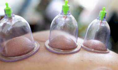 أعراض ما بعد الحجامة وكيفية التعامل معها