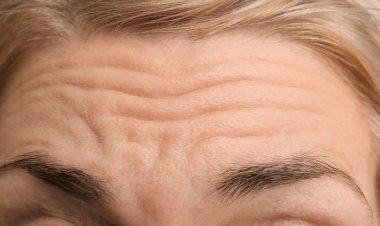 لخطوط الجبهة.. وصفات طبيعية تعيد شباب بشرتك دون تكاليف