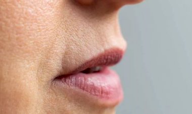 وصفات طبيعية لتفتيح المنطقة المحيطة بالفم.. خطوات بسيطة للحصول على لون بشرة موحّد