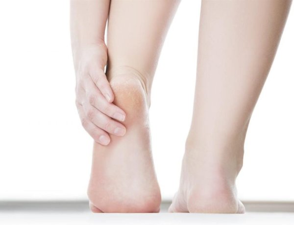 حلول طبيعية للتخلص من تشقق القدمين والعناية بهما في فصل الشتاء