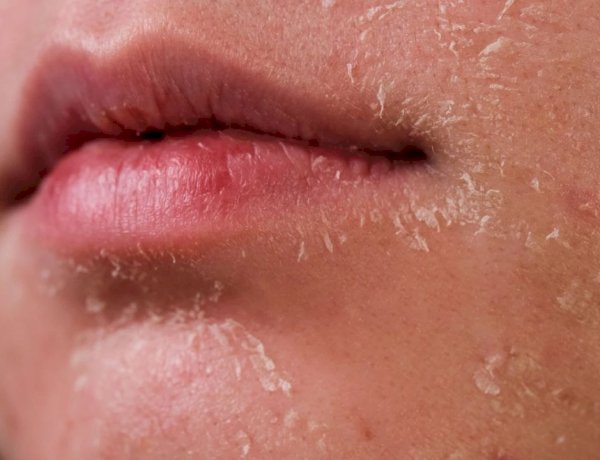 وصفات منزلية لتقشير وترطيب البشرة الجافة خلال الخريف والشتاء