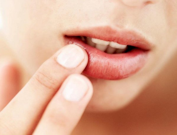 دليل شامل للتخلص من تشقق الشفاه بطرق طبيعية وآمنة