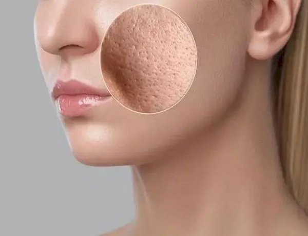 8 وصفات طبيعية لعلاج المسام الواسعة وتحسين ملمس البشرة