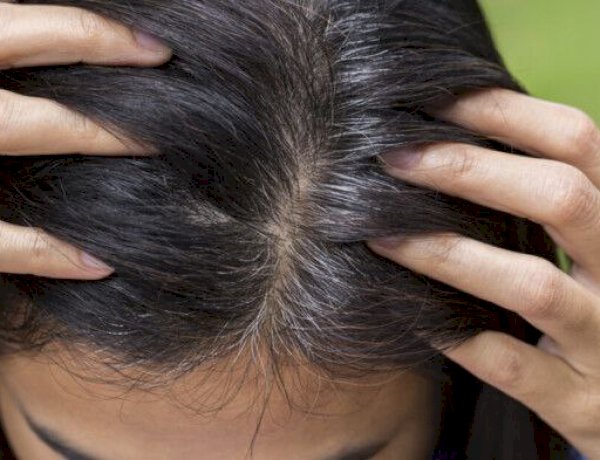 وصفة طبيعية وآمنة لإخفاء خصلات الشعر الأبيض بدون صبغات