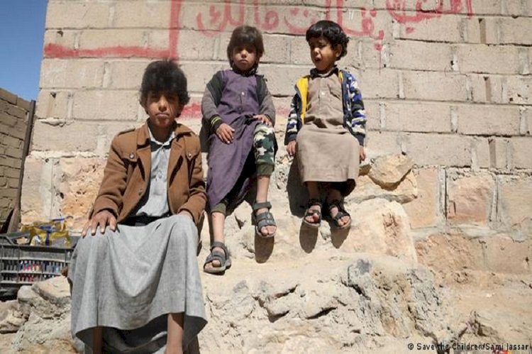 الحرب الأوكرانية تزيد من آلام اليمنيين.. استغلال حوثي ومجاعة تطارد الملايين