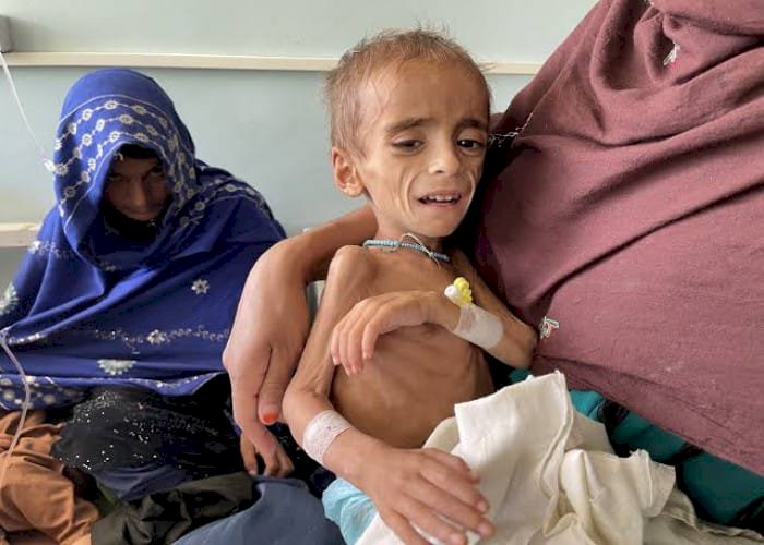 بعد خفض التمويلات.. ملايين من الشعب الأفغاني يواجهون خطر المجاعة
