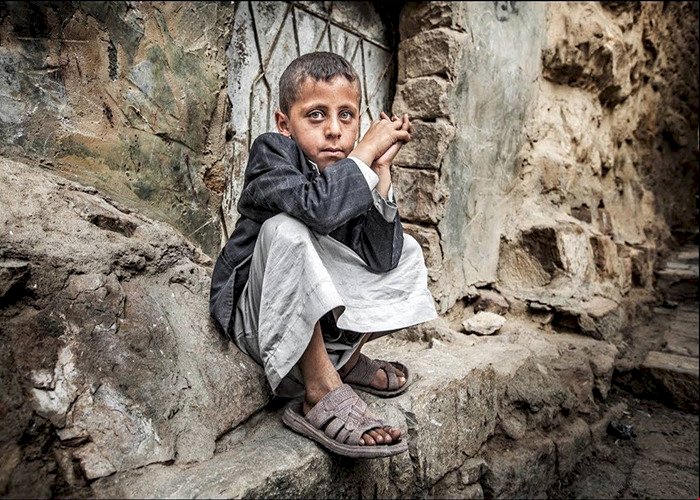 اليمن.. هكذا يواجه الأطفال خطر الموت جوعًا بسبب إرهاب الحوثي