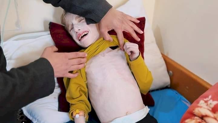 انقذوا فادي الزنط.. طفل مهدد بفقدان حياته نتيجة سوء التغذية والجفاف في غزة.. ما القصة؟