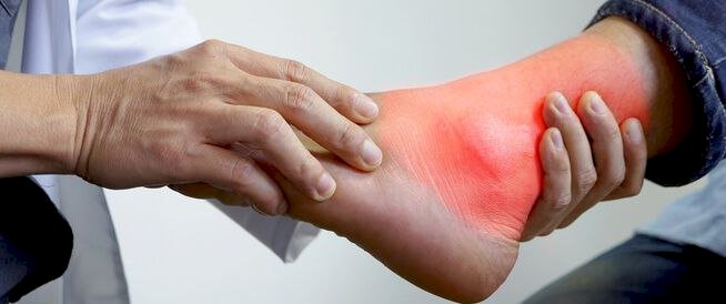 تعرف على علاج النقرس وأعراضه وطرق الوقاية منه