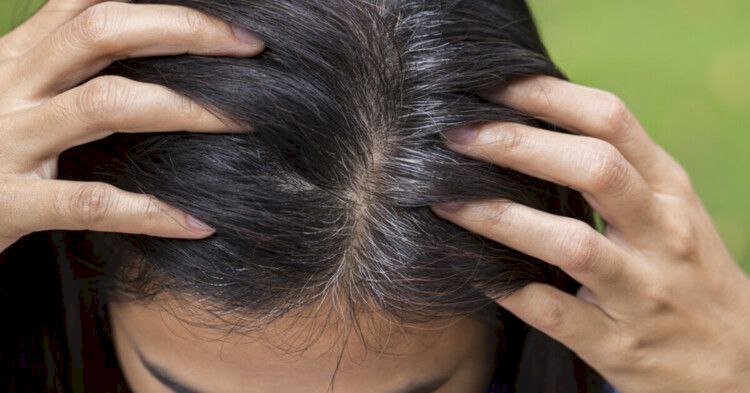 وصفة طبيعية وآمنة لإخفاء خصلات الشعر الأبيض بدون صبغات